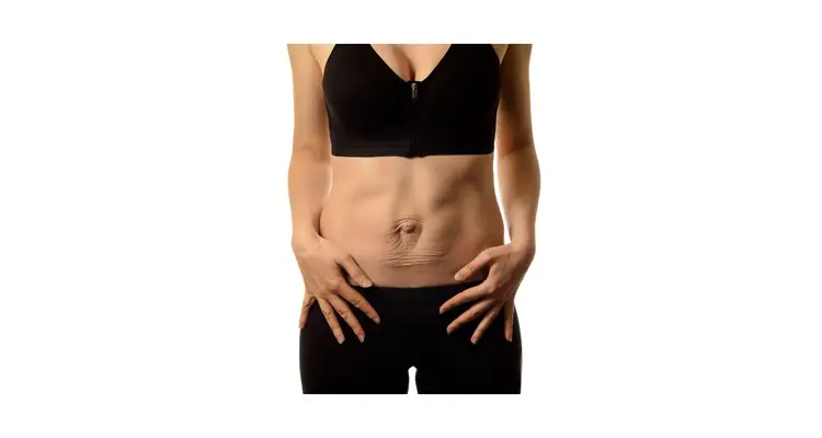 Diastasis Recti - What is It and How to Fix It [Videos]
